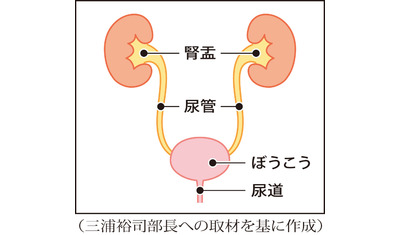 薬物療法が大きく進歩～ぼうこうなどの尿路上皮がん（虎の門病院　三浦裕司部長）～