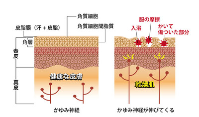 症状がなくても保湿、トラブル起こさない肌に