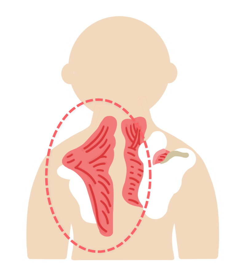 souboukin-shoulder-and-neck-2