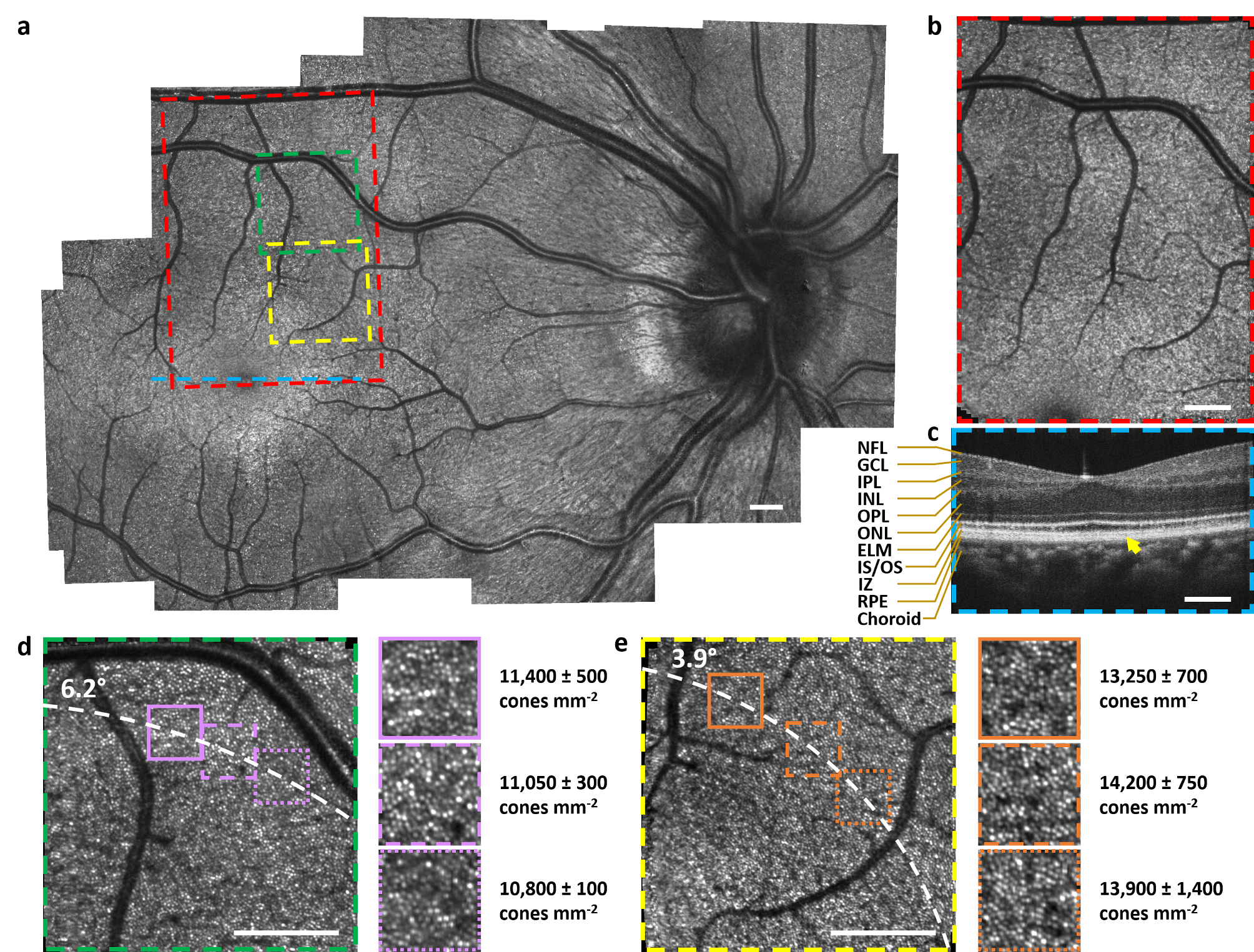    sdoct oct spectral domain optical coherence tomography  scanning laser ophthalmoscope SLO handheld  Sina Farsiu 