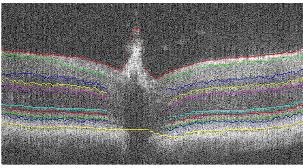 mouse retina rhoko Rho(−/−) Pratul P. Srinivasan farsiu sina segmentation automatic