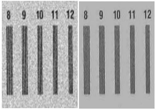   wavelet deblurring breast cancer digital tomosynthesis superresolution super resolution super-resolution xray  registration Sina Farsiu 