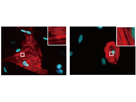 遺伝子導入でヒト心筋様細胞を作製