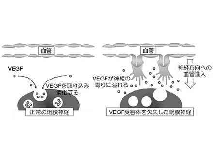 血管が網膜で排除される仕組みを解明