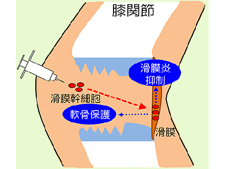 膝関節症を幹細胞注射で治療 東京医科歯科大がラットで効果実証