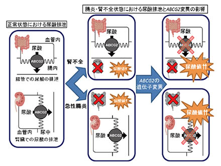 尿酸値は小腸障害のマーカーになる 防衛医大などが発見