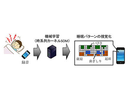 スマホ録音で簡単に睡眠パターンを可視化 障害の早期発見も可能に