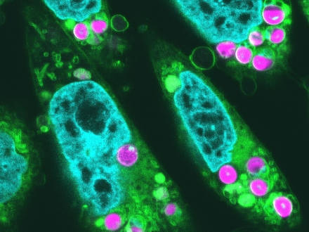 葉緑体を動物細胞に移植し、光合成の初期反応を確認 東大など