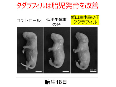 低出生体重児のモデルマウス作製、世代を超えた疾患リスク解明 東北大など