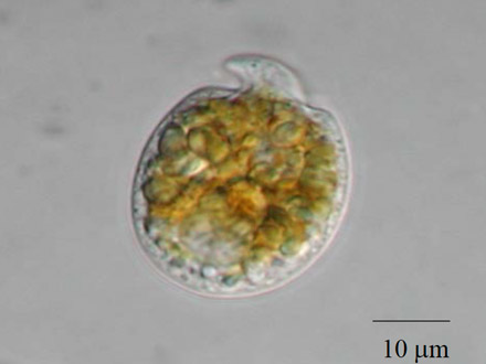 西表島近海の生物が持つ抗がん作用のある天然化合物の合成に成功 中央大と高知大