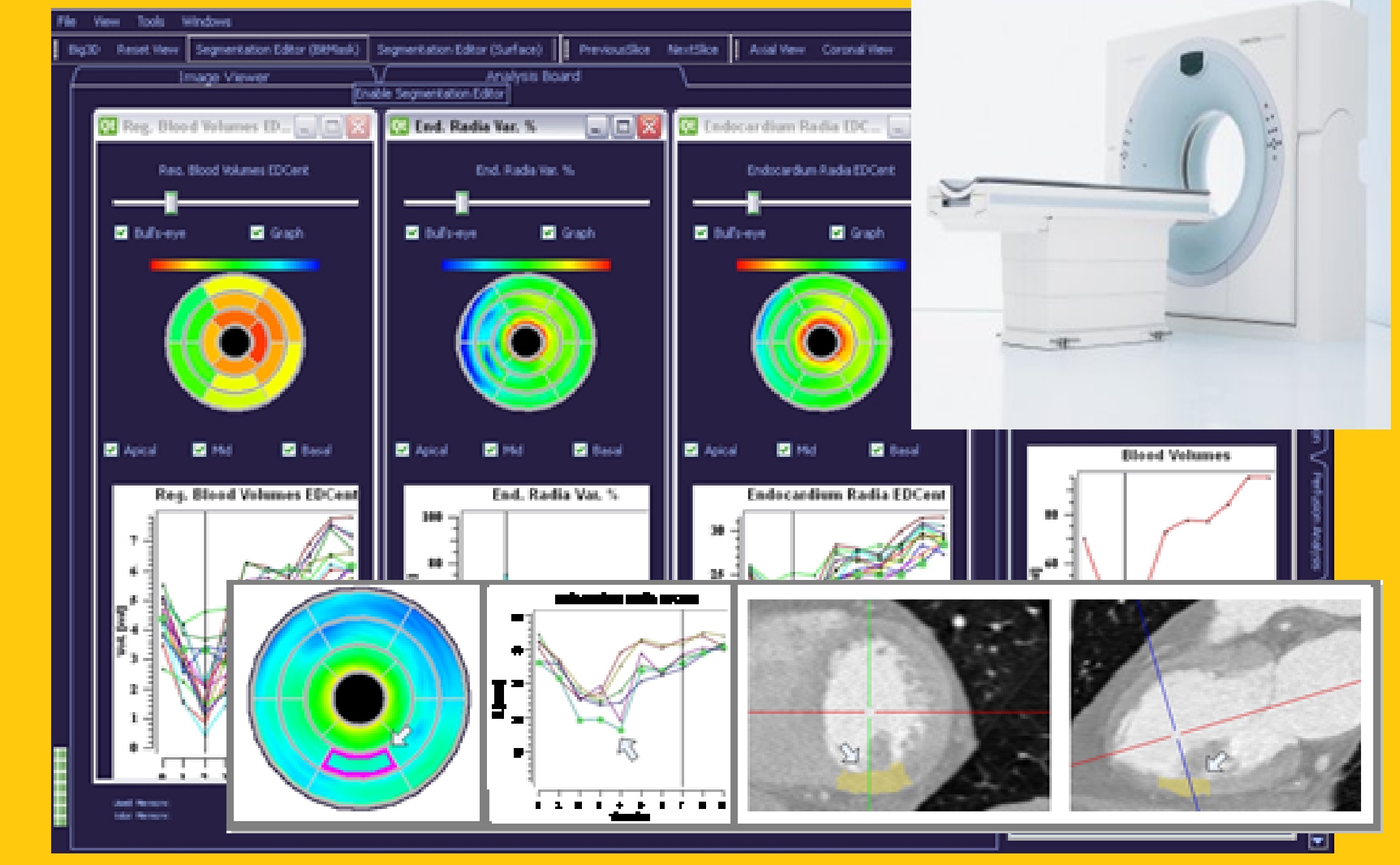 LV Functional Analysis